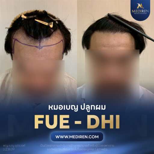 แถว 3 ภาพ 1