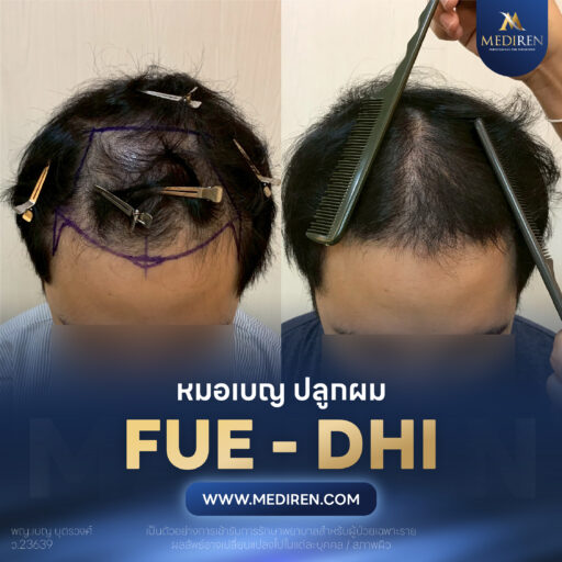 แถว 4 ภาพ 1
