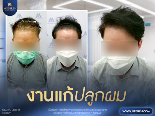 Case 10