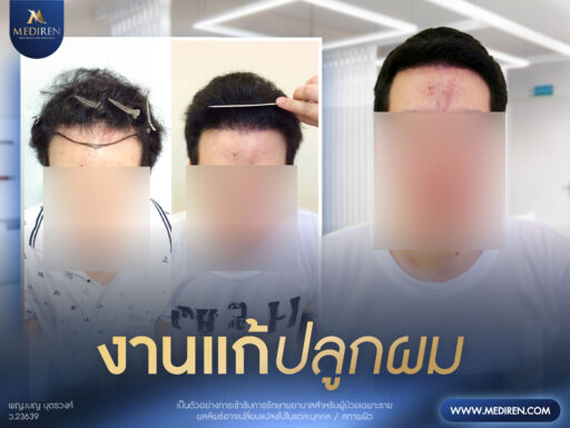 Case 6