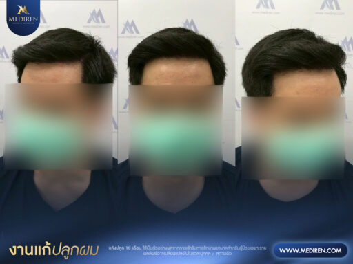 Case 8